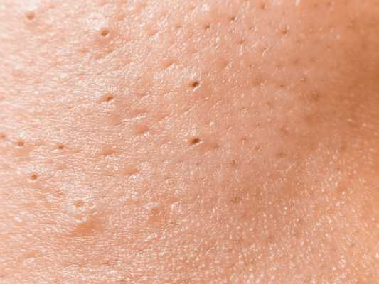 Adieu Points Noirs : Le Guide Expert des Meilleurs Produits à l'Acide Salicylique Coréens - PIBUKARE