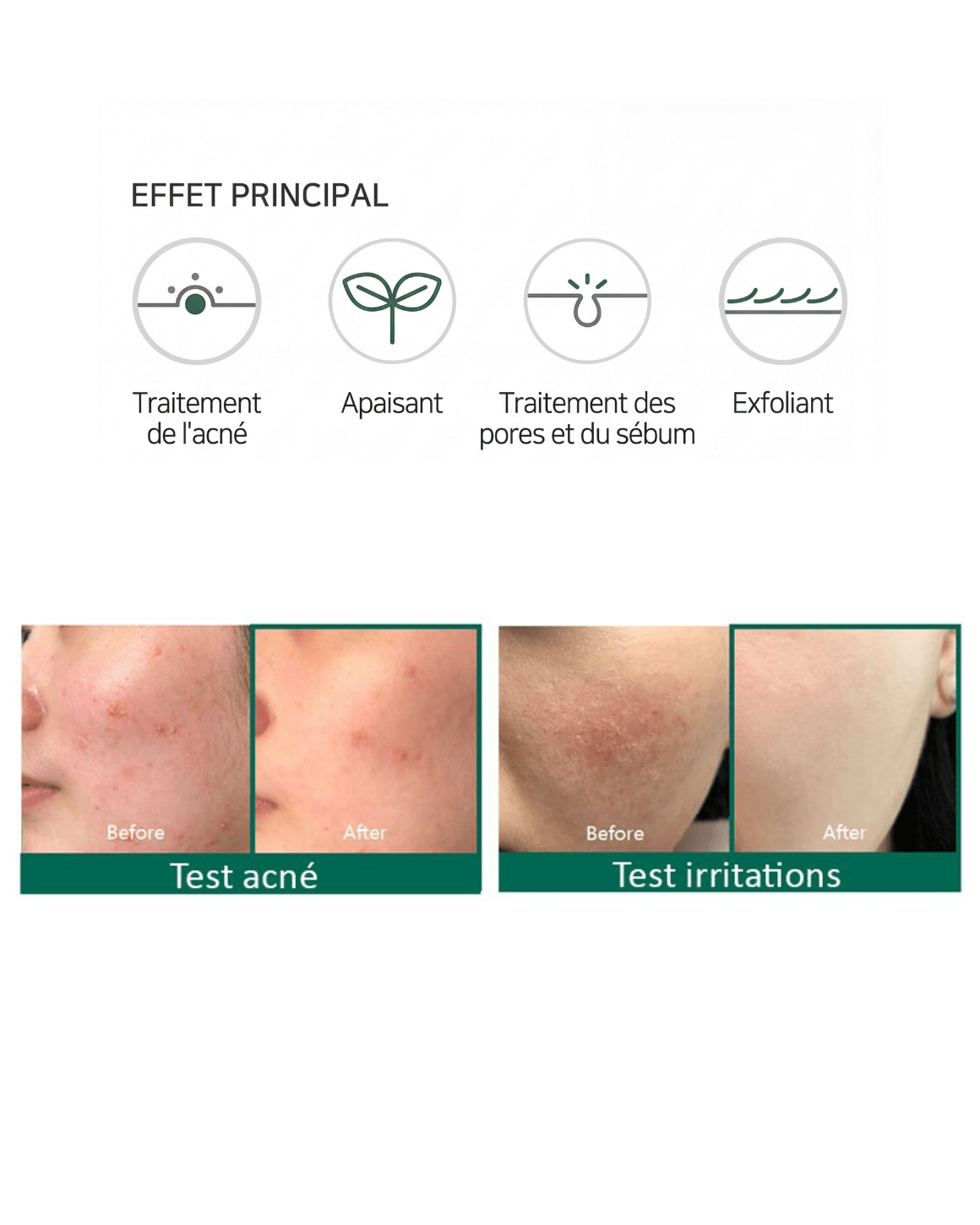 SOME BY MI - AHA, BHA, PHA Miracle Acne Clear Foam - 100 ml - PIBUKARE