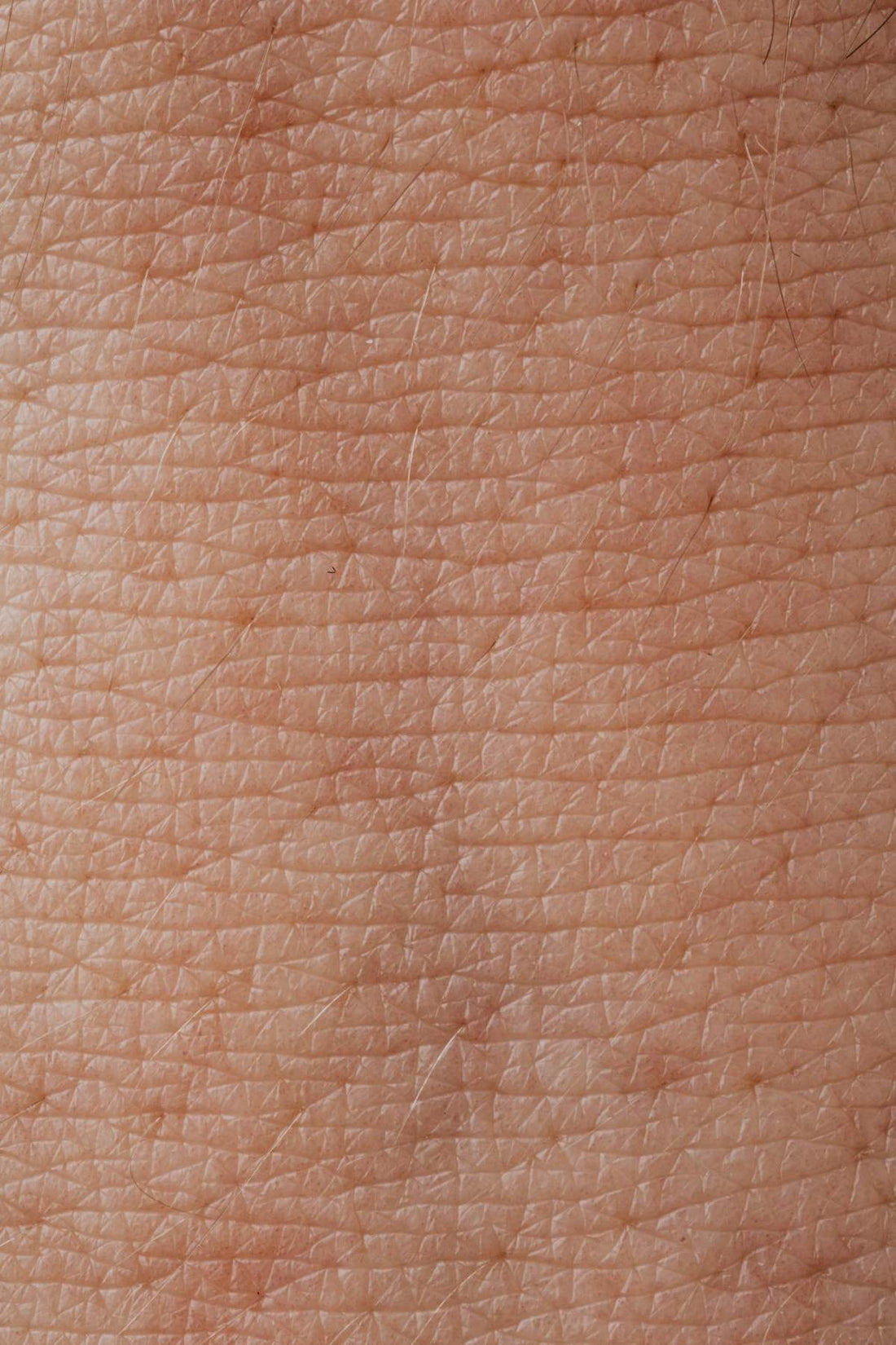 Comment traiter une peau sèche et déséquilibrée