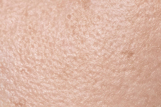 Démystifions les 4 mythes les plus courants sur les pores