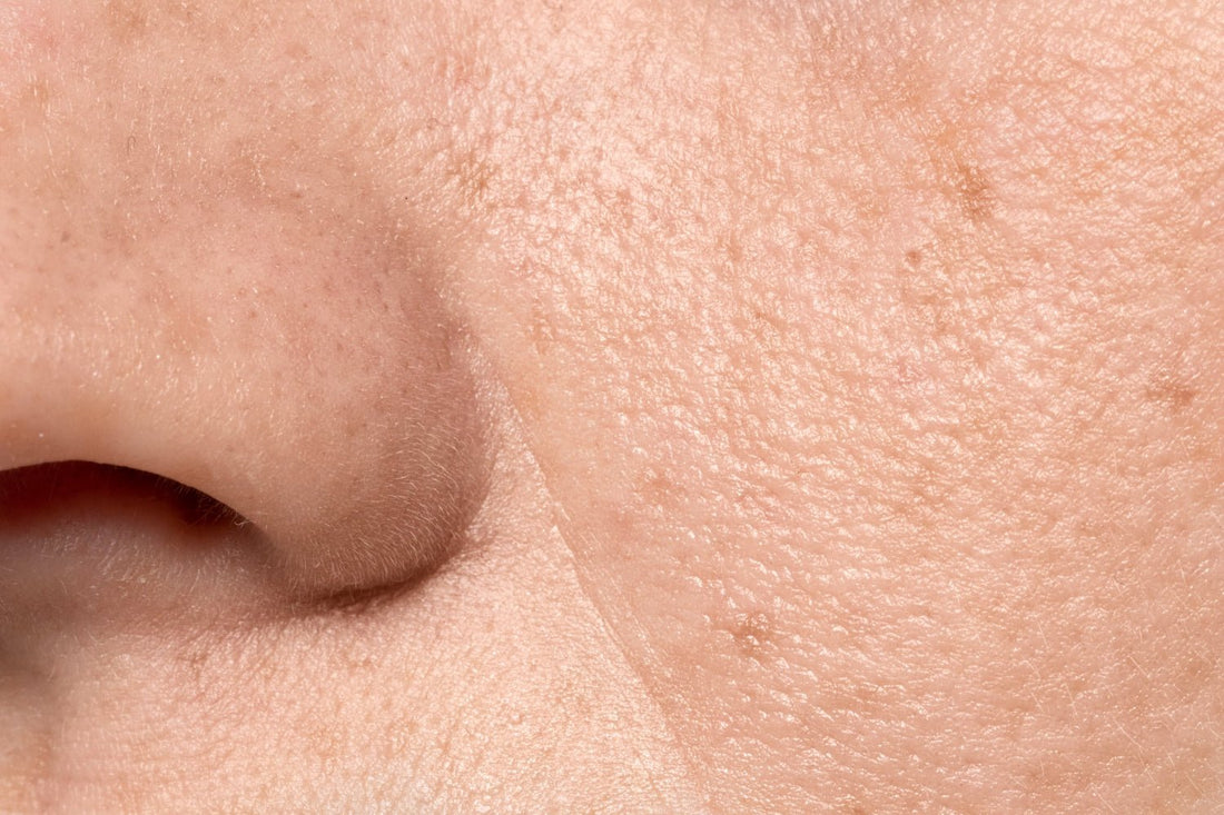 Les meilleurs ingrédients pour le soin des pores - PIBUKARE