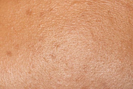 Maîtrisez votre peau grasse avec les secrets de la K-Beauty