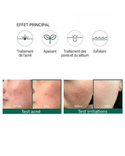 SOME BY MI - AHA, BHA, PHA Miracle Acne Clear Foam - 100 ml - PIBUKARE