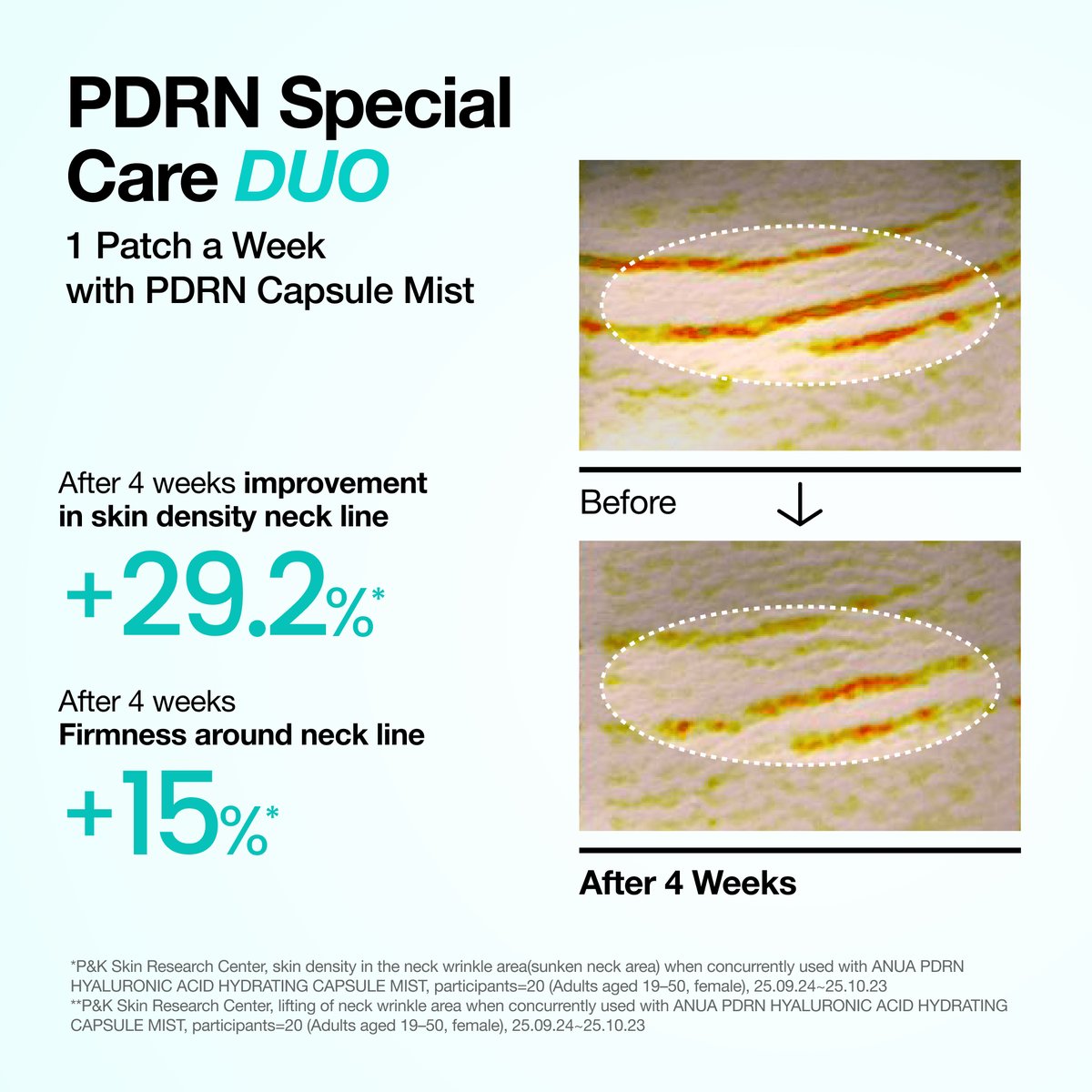 Anua - PDRN Collagen Melting Patch For Neck - 4 patchs