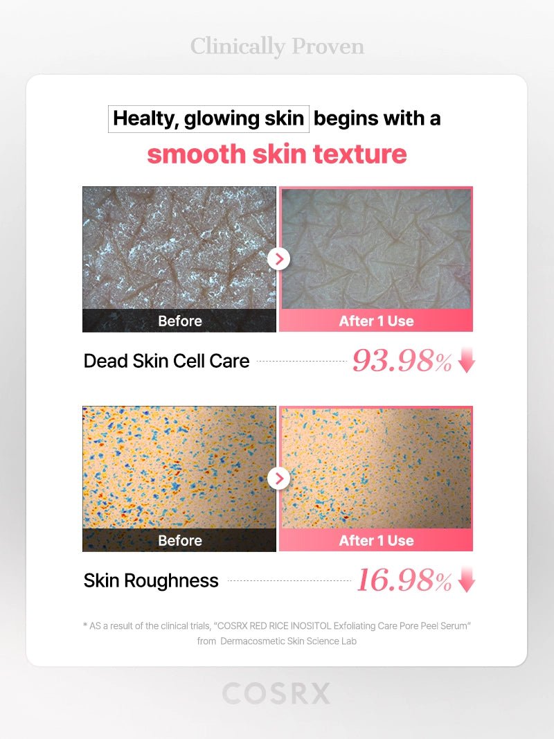 COSRX : COSRX RED RICE INOSITOL Exfoliating Care Pore Wash-Off Peel Serum