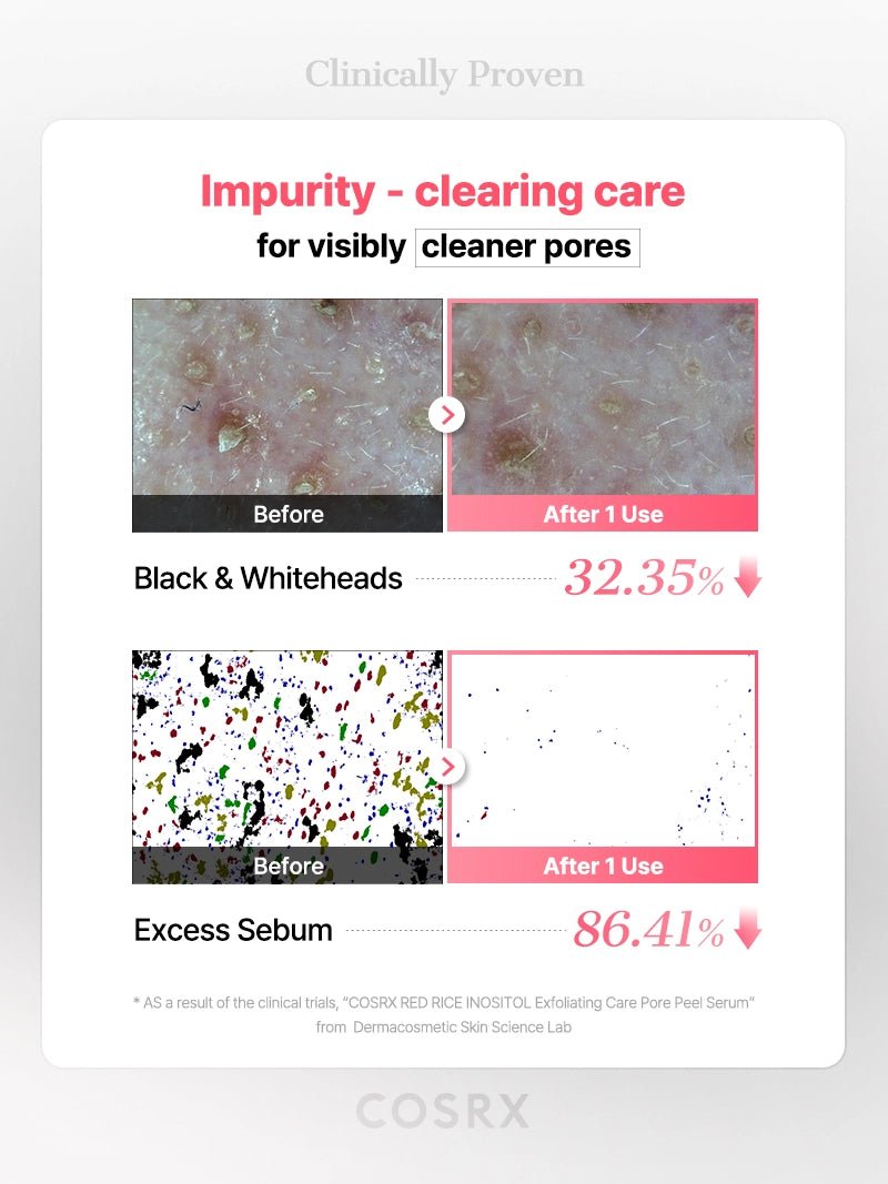 COSRX : COSRX RED RICE INOSITOL Exfoliating Care Pore Wash-Off Peel Serum