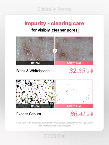 COSRX : COSRX RED RICE INOSITOL Exfoliating Care Pore Wash-Off Peel Serum