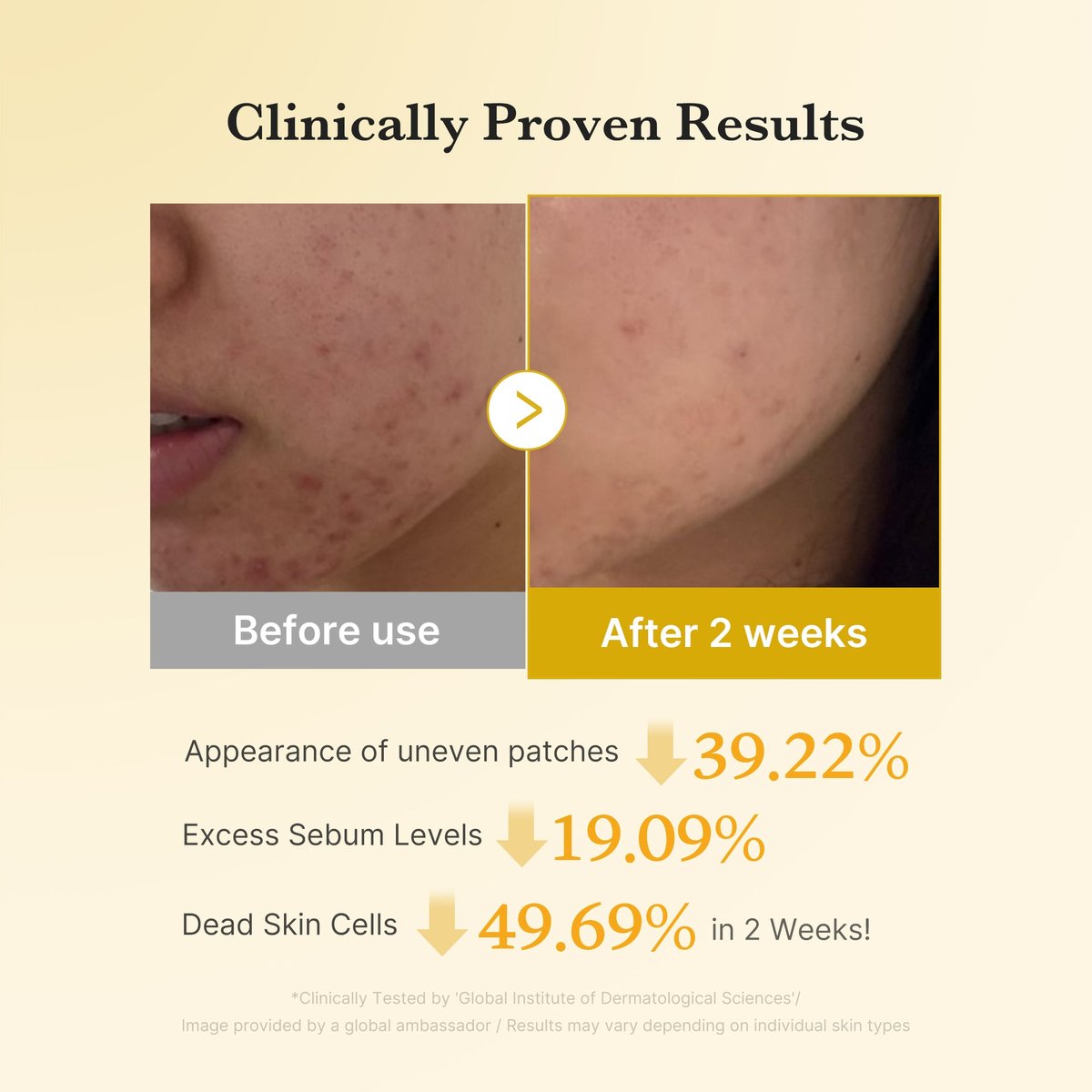 Medicube : Kojic Acid Tumeric Toner Pad