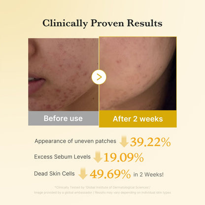 Medicube : Kojic Acid Tumeric Toner Pad