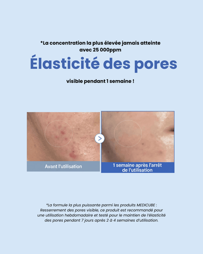 MEDICUBE - One Day Exosome Shot Pore Ampoule 25000 - 13ml - PIBUKARE