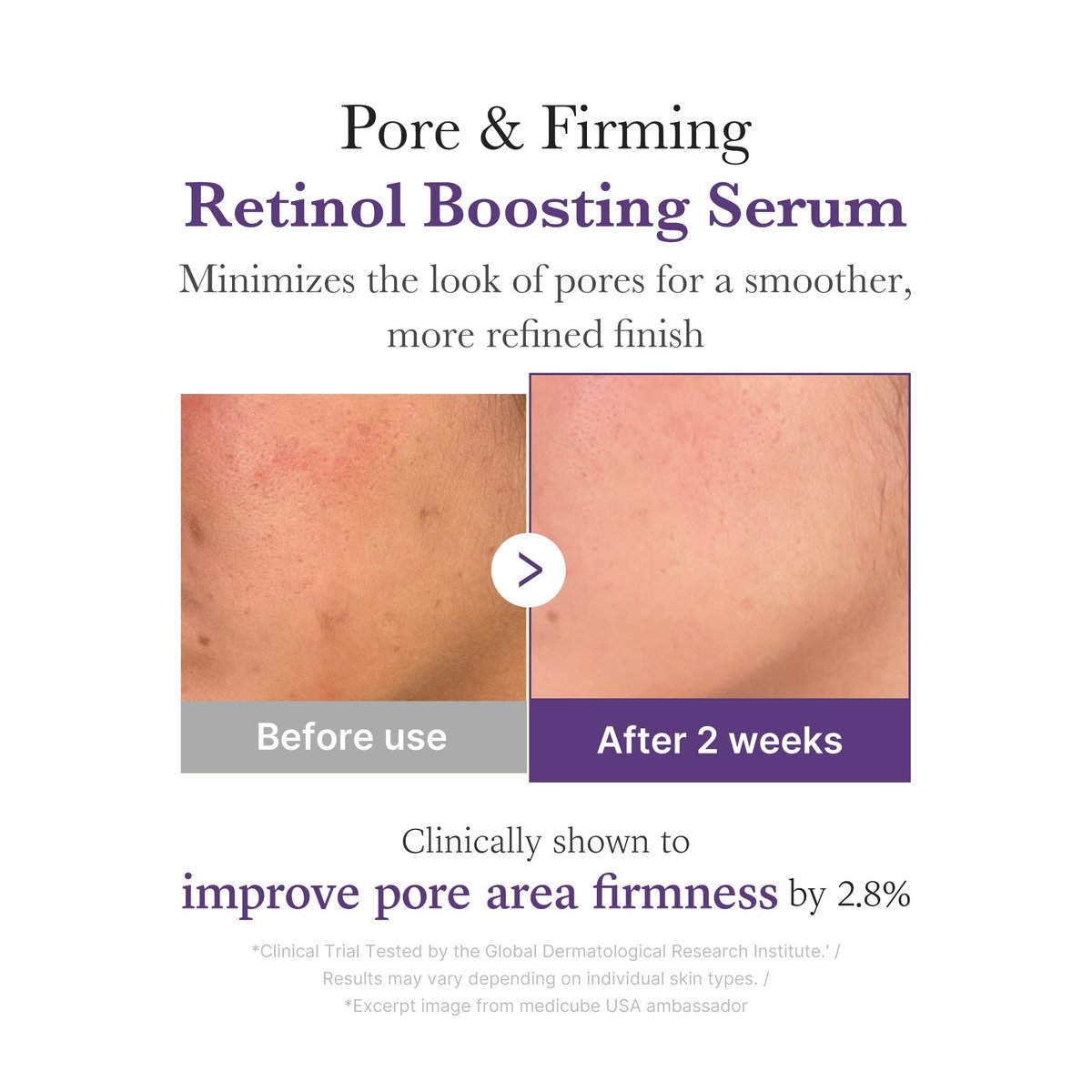 Medicube : Retinol NMN Boosting Serum
