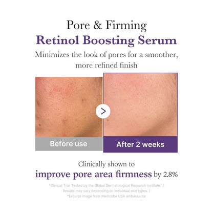 Medicube : Retinol NMN Boosting Serum