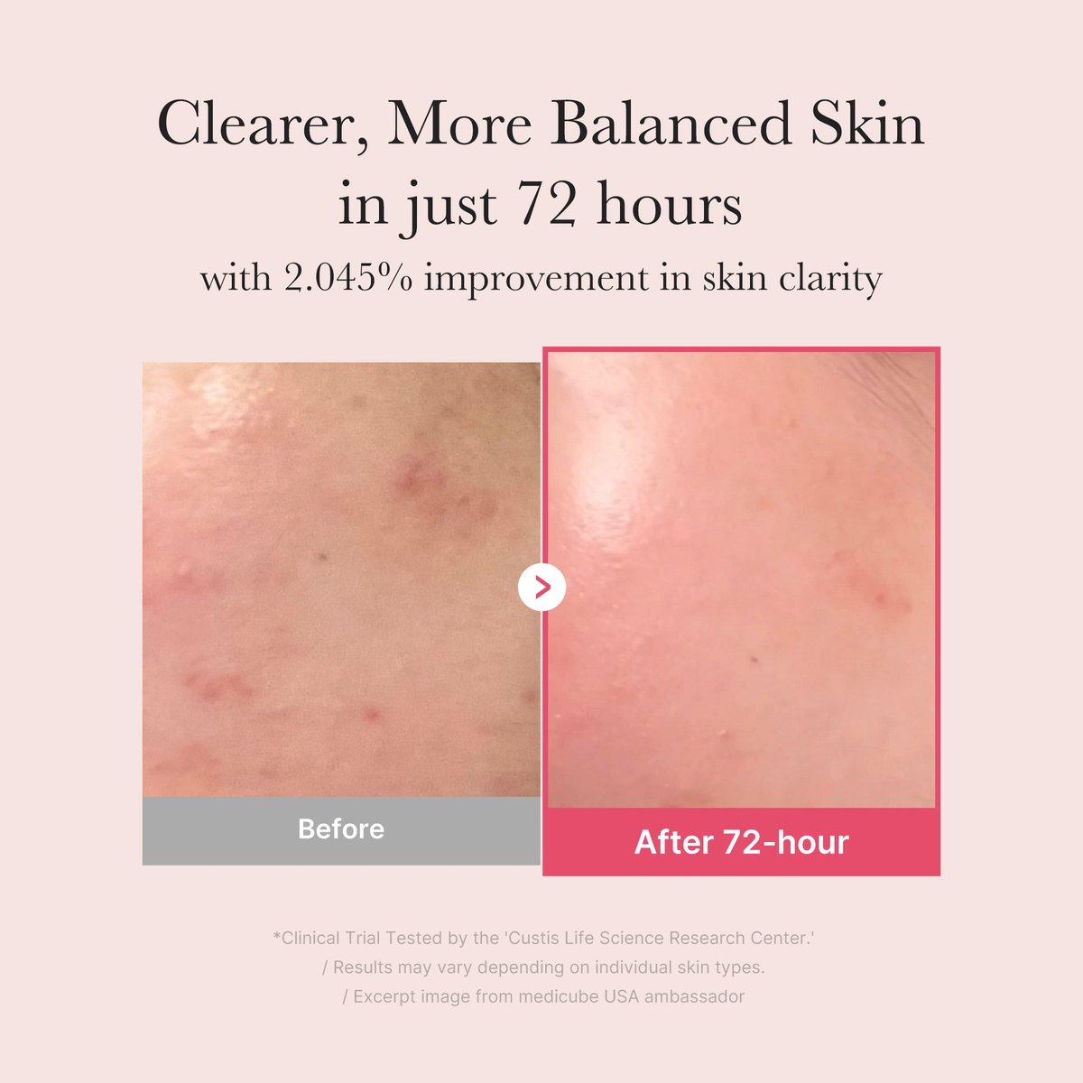 Medicube : TXA Niacinamide Serum