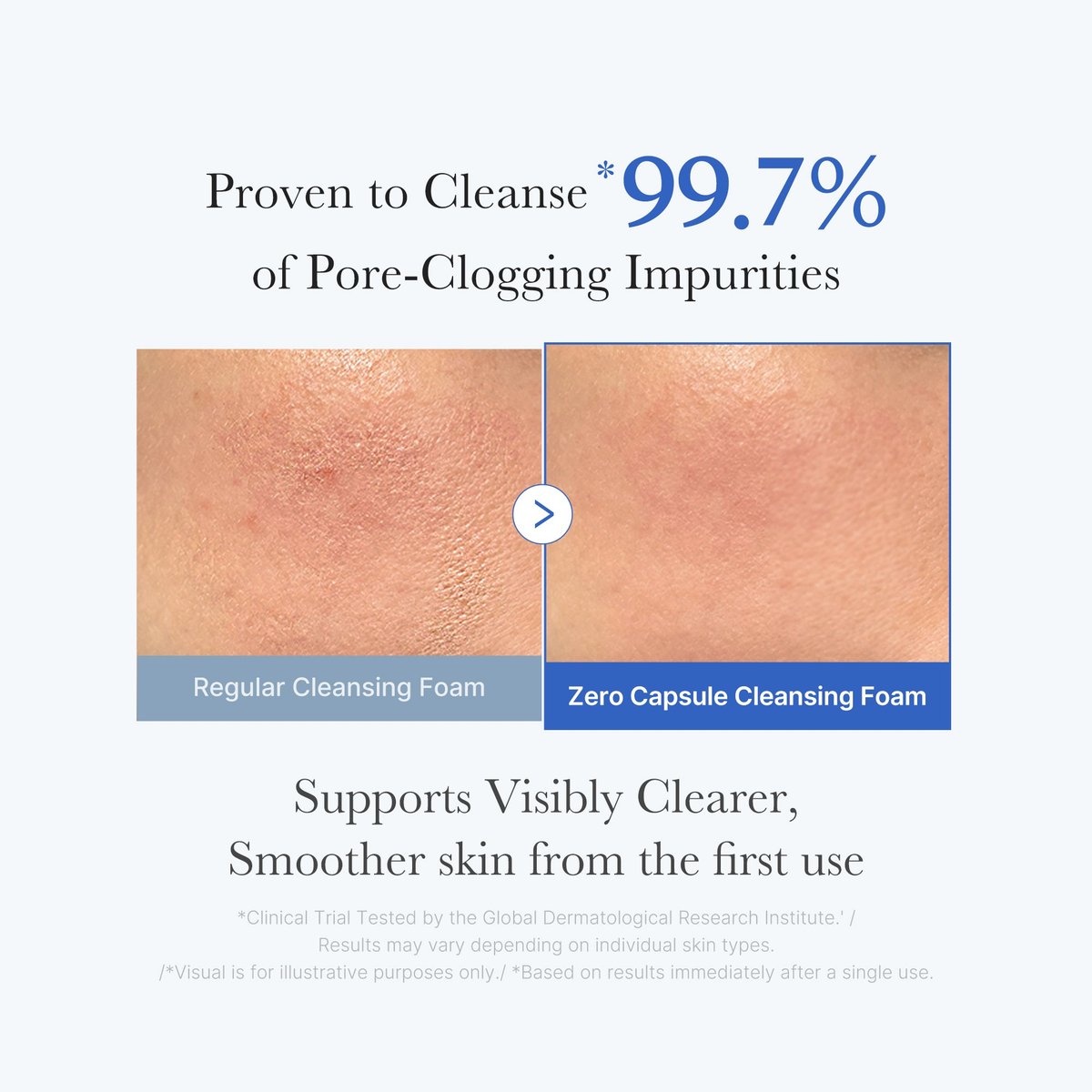 Medicube : Zero Pore Capsule Cleansing Foam