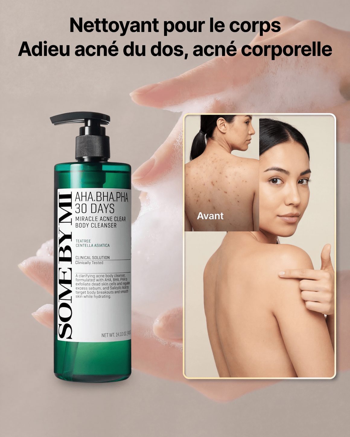 SOME BY MI - AHA, BHA, PHA 30 Days Miracle Acne Clear Body Cleanser - 400g - PIBUKARE